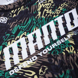 Манто искажает сыпь